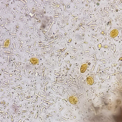 Giardia lamblia cysts and Trophozoite under 40X light microscope chinchilla protozoa